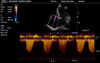 Mindray Ultrasound M7 Premium