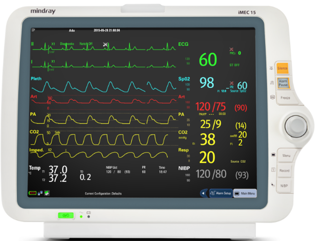 Mindray Patient Monitor IMEC 15