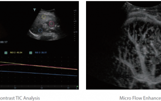 Mindray Ultrasound Resona 7