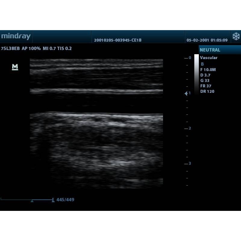Mindray Ultrasound DP-10