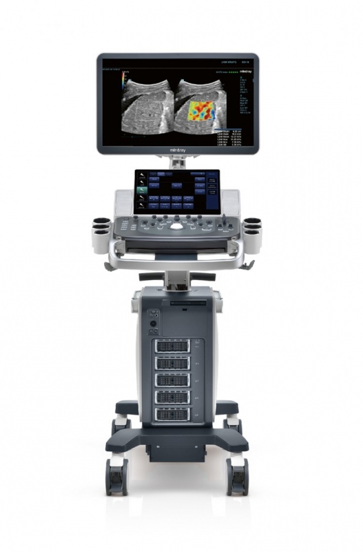 Mindray Ultrasound DC-80A