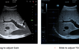 Mindray Ultrasound TE7