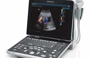 Mindray Ultrasound Z5
