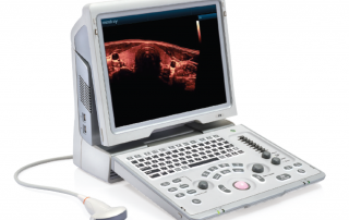 Mindray Ultrasound Z6