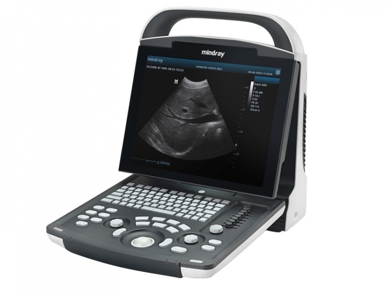 Mindray Ultrasound DP-20