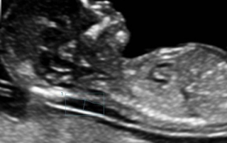 Mindray Ultrasound Resona 6